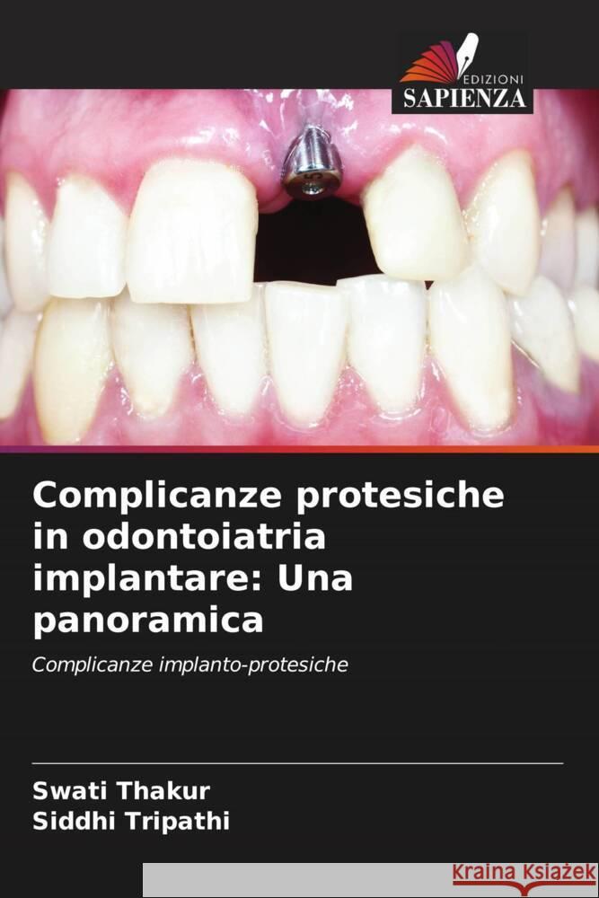 Complicanze protesiche in odontoiatria implantare: Una panoramica Thakur, Swati, Tripathi, Siddhi 9786205452707