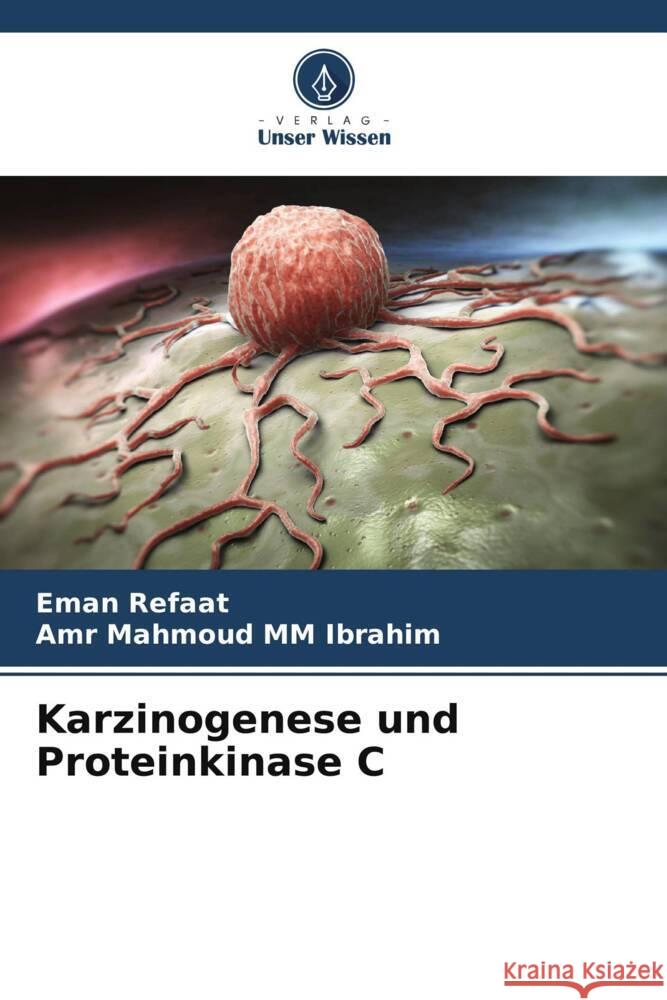 Karzinogenese und Proteinkinase C Refaat, Eman, MM Ibrahim, Amr Mahmoud 9786205452714