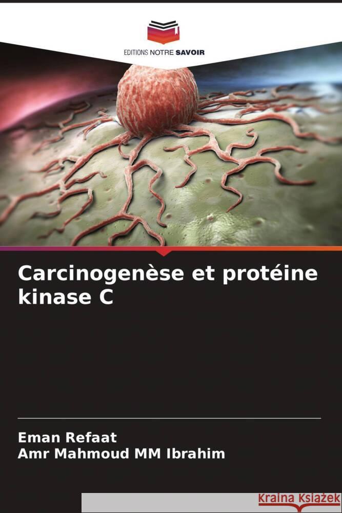 Carcinogenèse et protéine kinase C Refaat, Eman, MM Ibrahim, Amr Mahmoud 9786205452738 Editions Notre Savoir