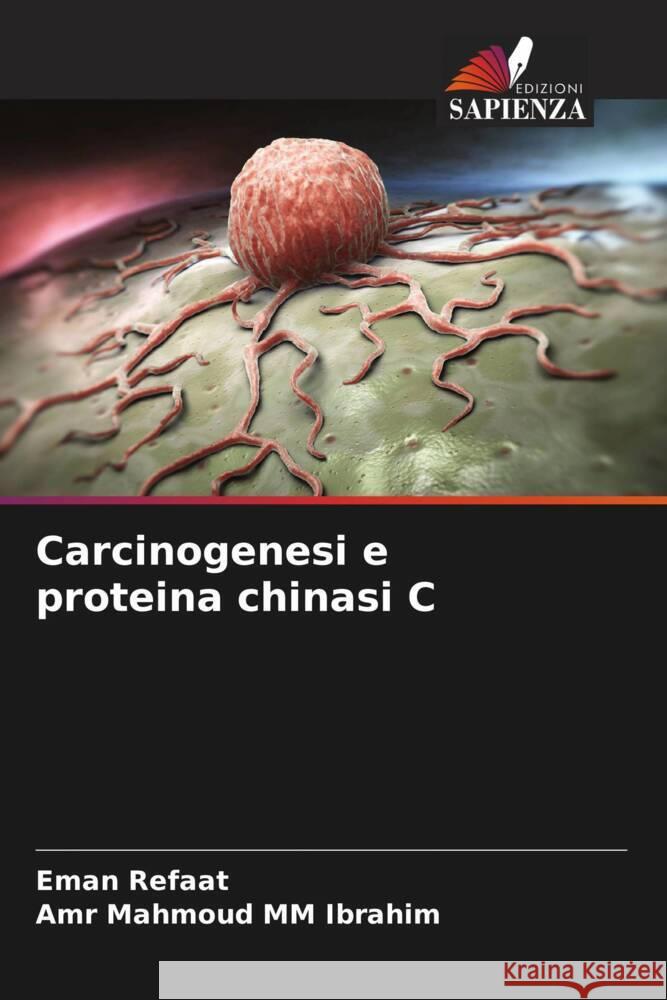 Carcinogenesi e proteina chinasi C Refaat, Eman, MM Ibrahim, Amr Mahmoud 9786205452745