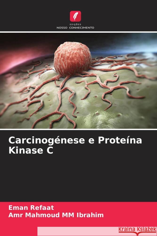 Carcinogénese e Proteína Kinase C Refaat, Eman, MM Ibrahim, Amr Mahmoud 9786205452752 Edições Nosso Conhecimento