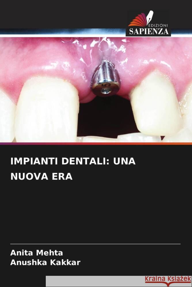 IMPIANTI DENTALI: UNA NUOVA ERA Mehta, Anita, Kakkar, Anushka 9786205453124