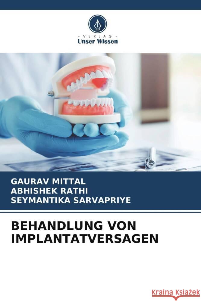 BEHANDLUNG VON IMPLANTATVERSAGEN Mittal, Gaurav, Rathi, Abhishek, SARVAPRIYE, SEYMANTIKA 9786205460078 Verlag Unser Wissen