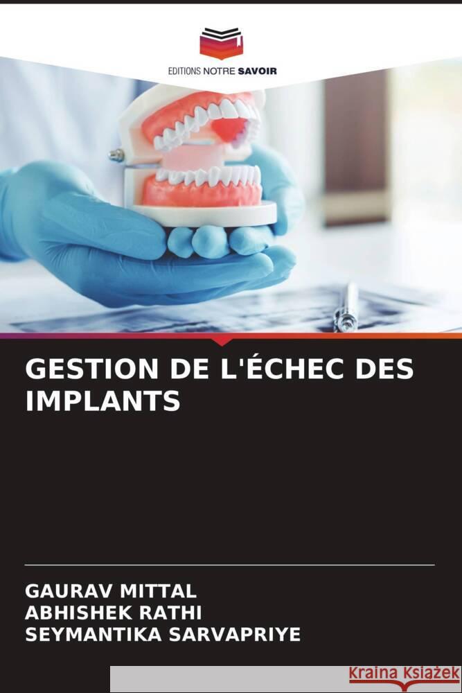 GESTION DE L'ÉCHEC DES IMPLANTS Mittal, Gaurav, Rathi, Abhishek, SARVAPRIYE, SEYMANTIKA 9786205460092