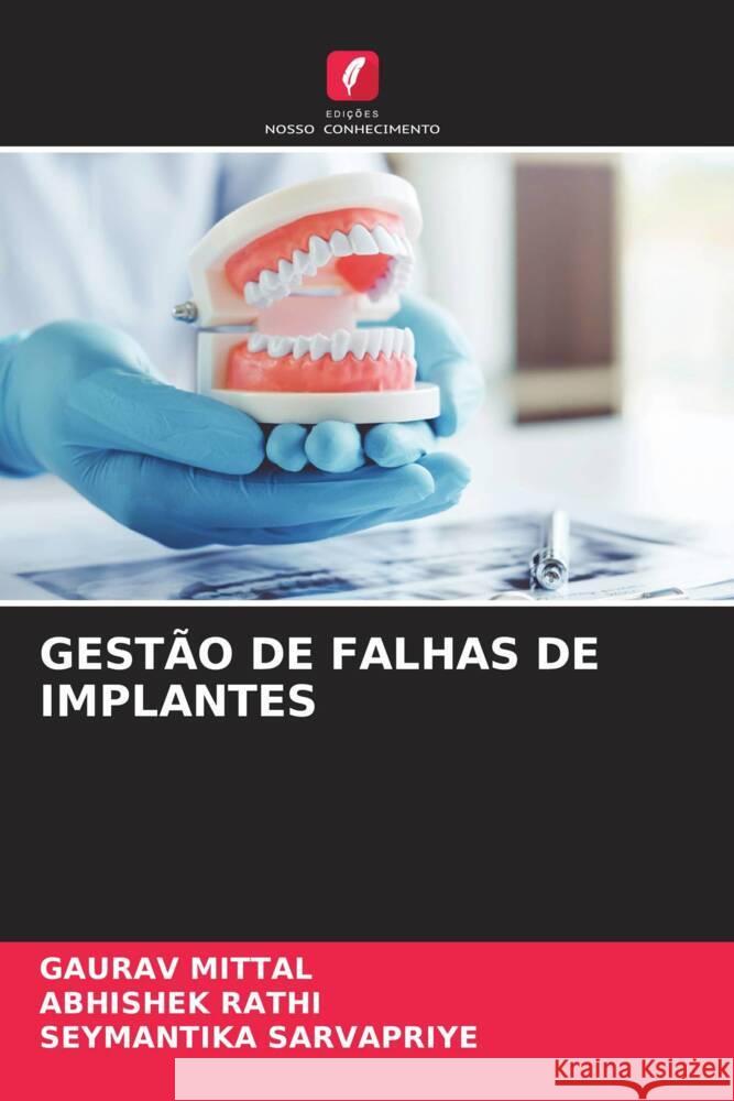 GESTÃO DE FALHAS DE IMPLANTES Mittal, Gaurav, Rathi, Abhishek, SARVAPRIYE, SEYMANTIKA 9786205460115