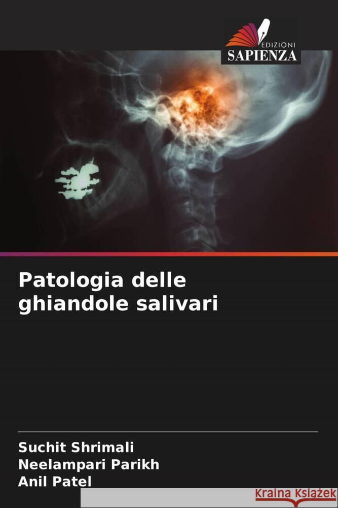 Patologia delle ghiandole salivari Shrimali, Suchit, Parikh, Neelampari, Patel, Anil 9786205460900