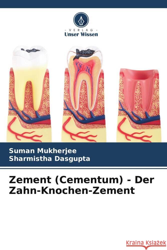 Zement (Cementum) - Der Zahn-Knochen-Zement Mukherjee, Suman, Dasgupta, Sharmistha 9786205464014