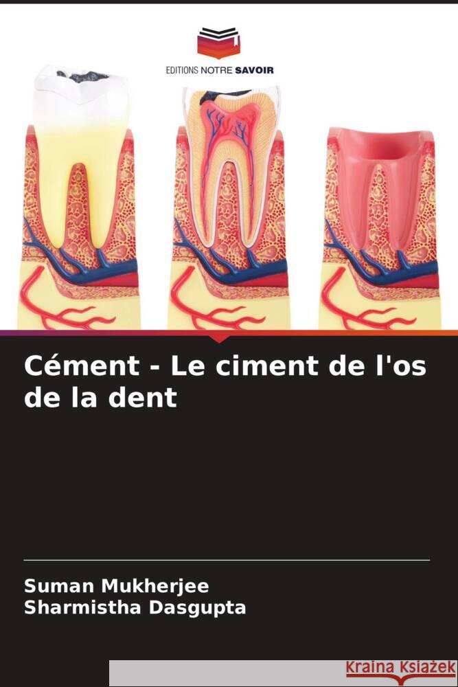 Cément - Le ciment de l'os de la dent Mukherjee, Suman, Dasgupta, Sharmistha 9786205464038