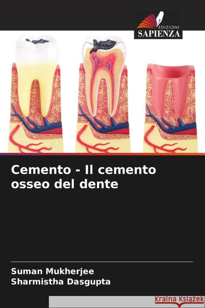 Cemento - Il cemento osseo del dente Mukherjee, Suman, Dasgupta, Sharmistha 9786205465653