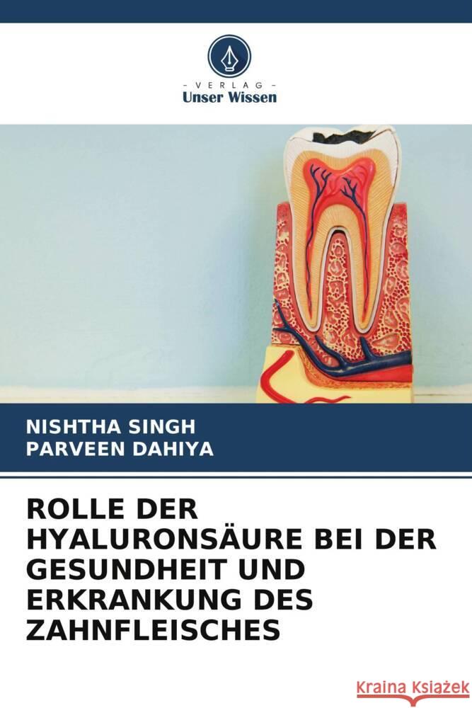 ROLLE DER HYALURONSÄURE BEI DER GESUNDHEIT UND ERKRANKUNG DES ZAHNFLEISCHES Singh, Nishtha, Dahiya, Parveen 9786205470053