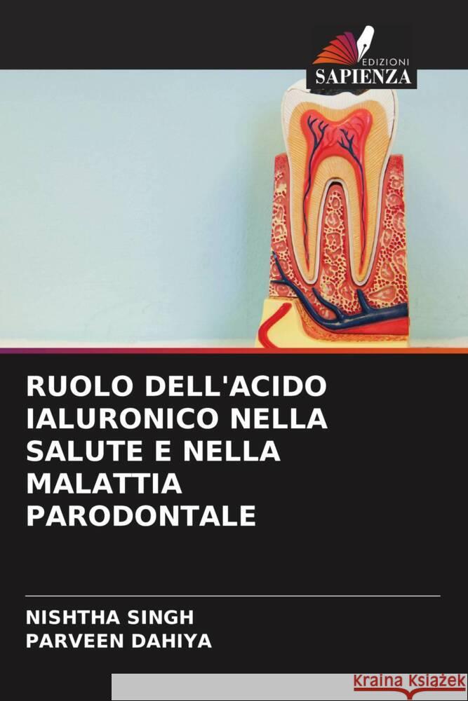 RUOLO DELL'ACIDO IALURONICO NELLA SALUTE E NELLA MALATTIA PARODONTALE Singh, Nishtha, Dahiya, Parveen 9786205470572