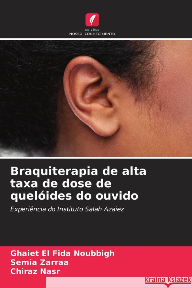 Braquiterapia de alta taxa de dose de quelóides do ouvido Noubbigh, Ghaiet El Fida, Zarraa, Semia, Nasr, Chiraz 9786205472767 Edições Nosso Conhecimento