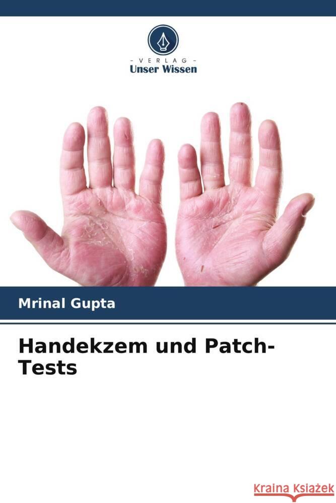 Handekzem und Patch-Tests Gupta, Mrinal 9786205476659