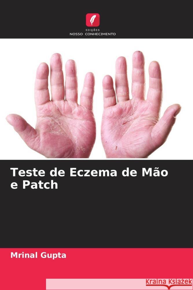 Teste de Eczema de Mão e Patch Gupta, Mrinal 9786205476680
