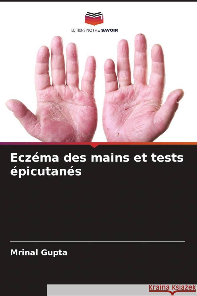 Eczéma des mains et tests épicutanés Gupta, Mrinal 9786205476697