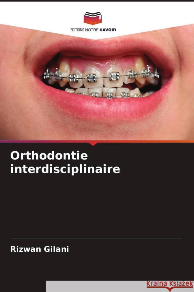 Orthodontie interdisciplinaire Gilani, Rizwan 9786205485408 Editions Notre Savoir