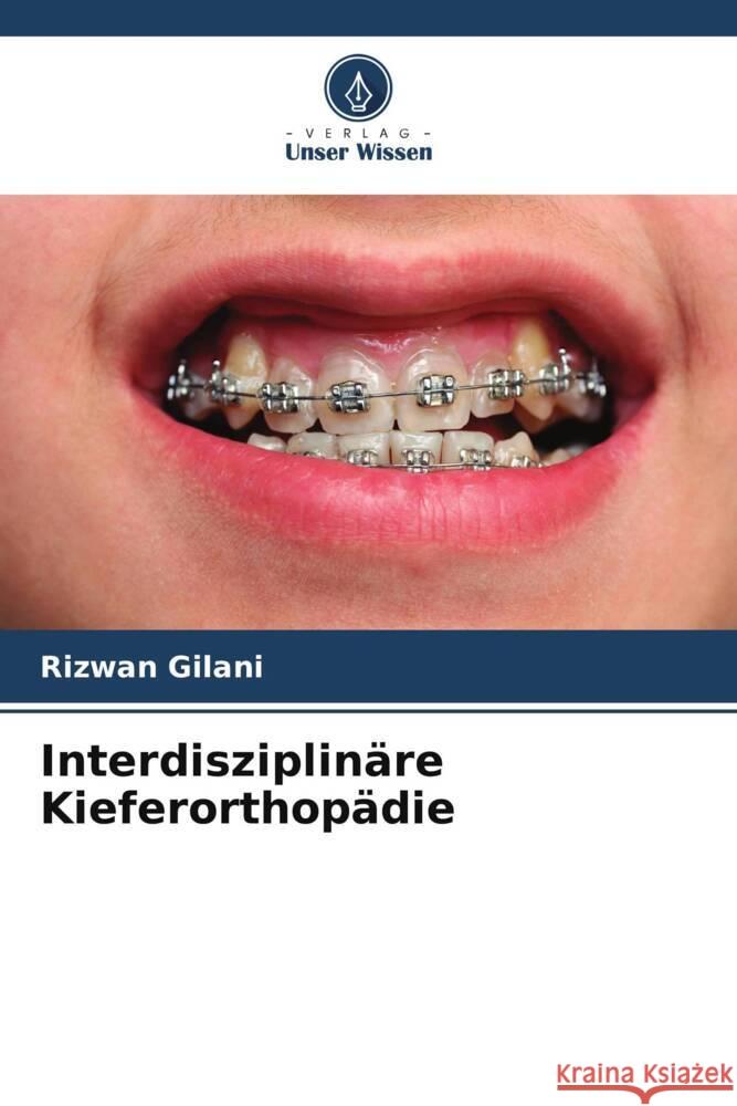 Interdisziplinäre Kieferorthopädie Gilani, Rizwan 9786205485422