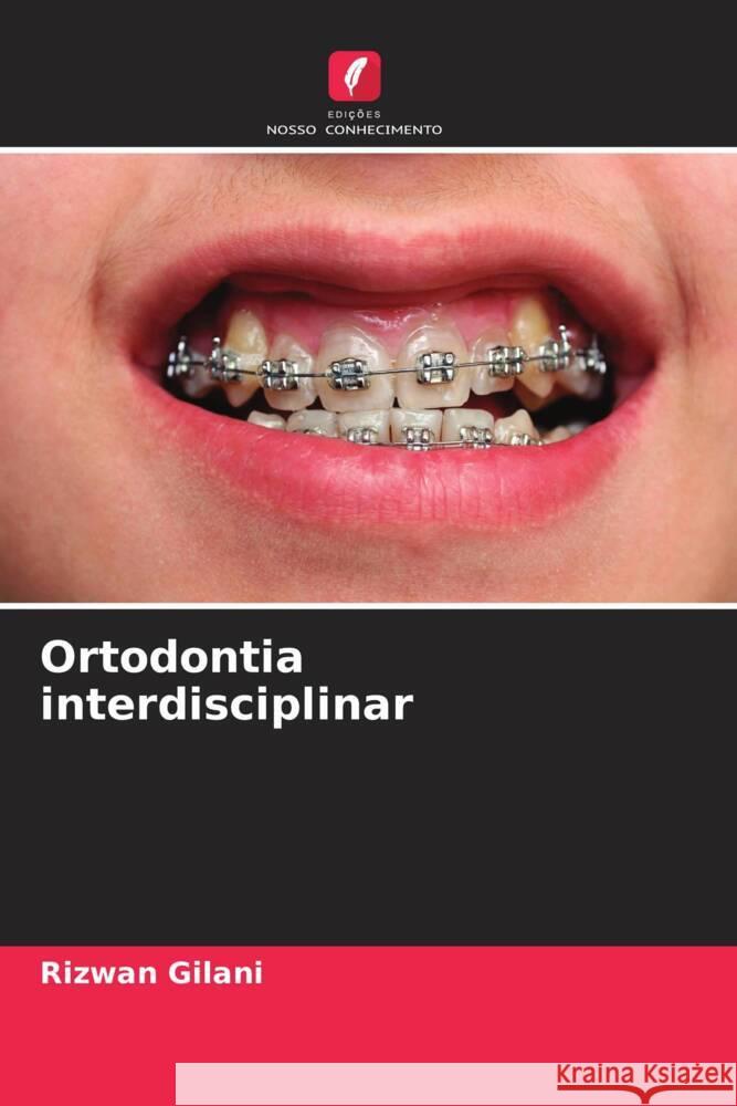 Ortodontia interdisciplinar Gilani, Rizwan 9786205485514