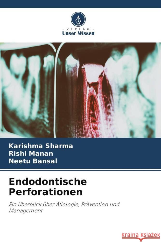 Endodontische Perforationen Sharma, Karishma, Manan, Rishi, Bansal, Neetu 9786205486030 Verlag Unser Wissen