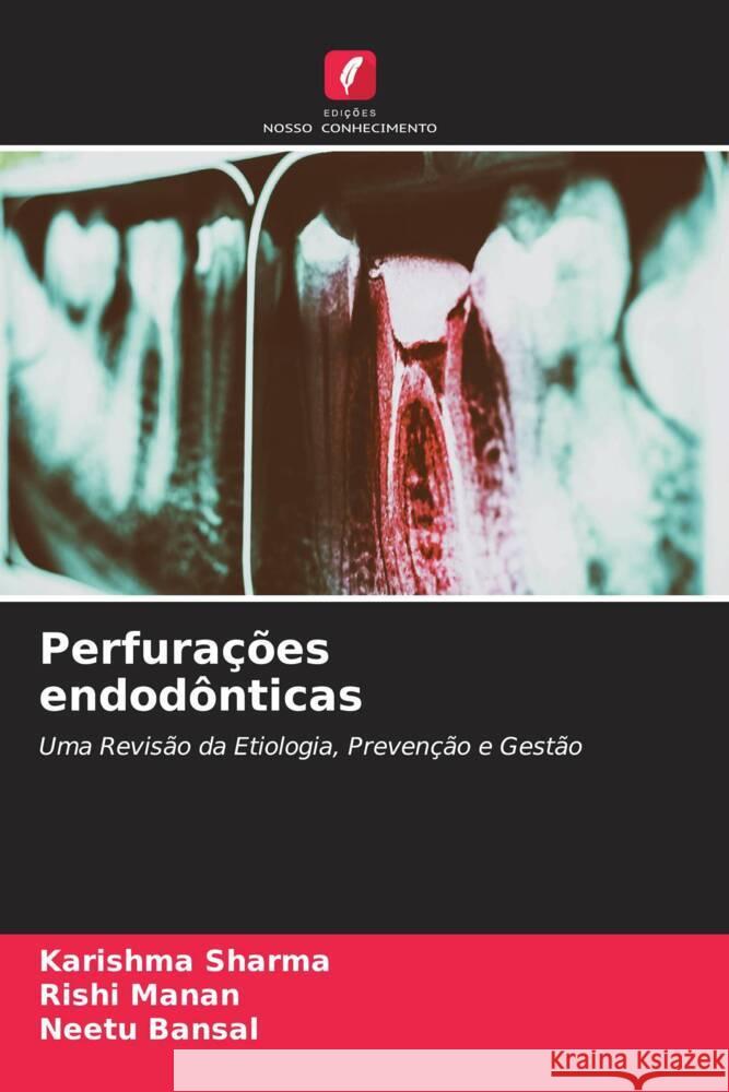 Perfurações endodônticas Sharma, Karishma, Manan, Rishi, Bansal, Neetu 9786205486085