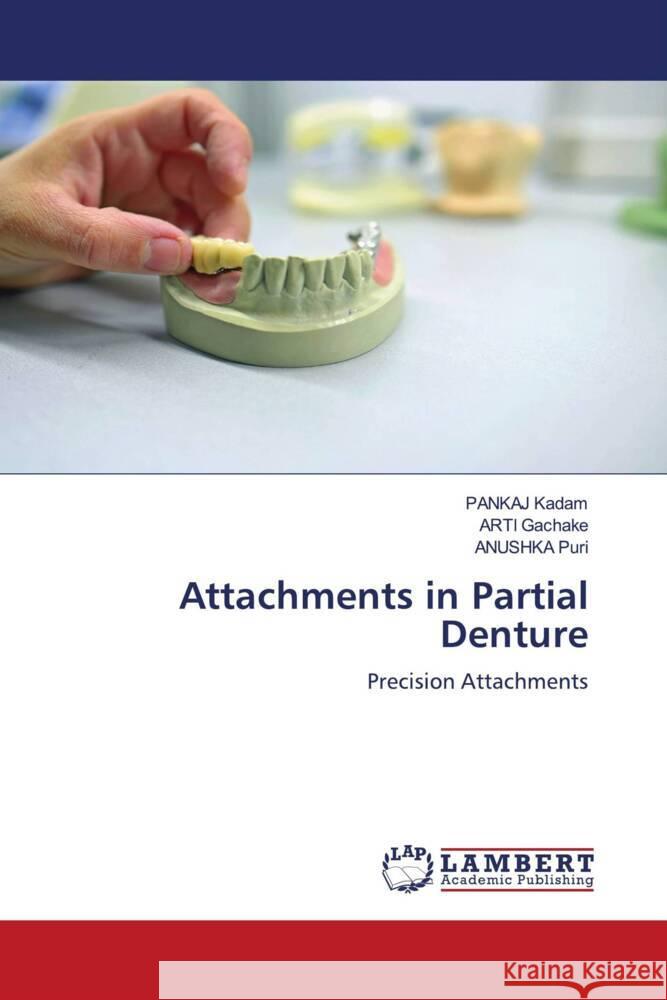 Attachments in Partial Denture Kadam, Pankaj, GACHAKE, ARTI, PURI, ANUSHKA 9786205488232