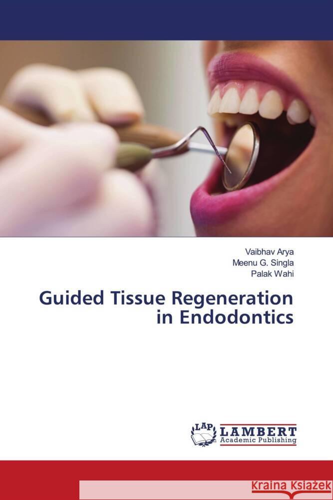 Guided Tissue Regeneration in Endodontics Arya, Vaibhav, Singla, Meenu G., Wahi, Palak 9786205490020