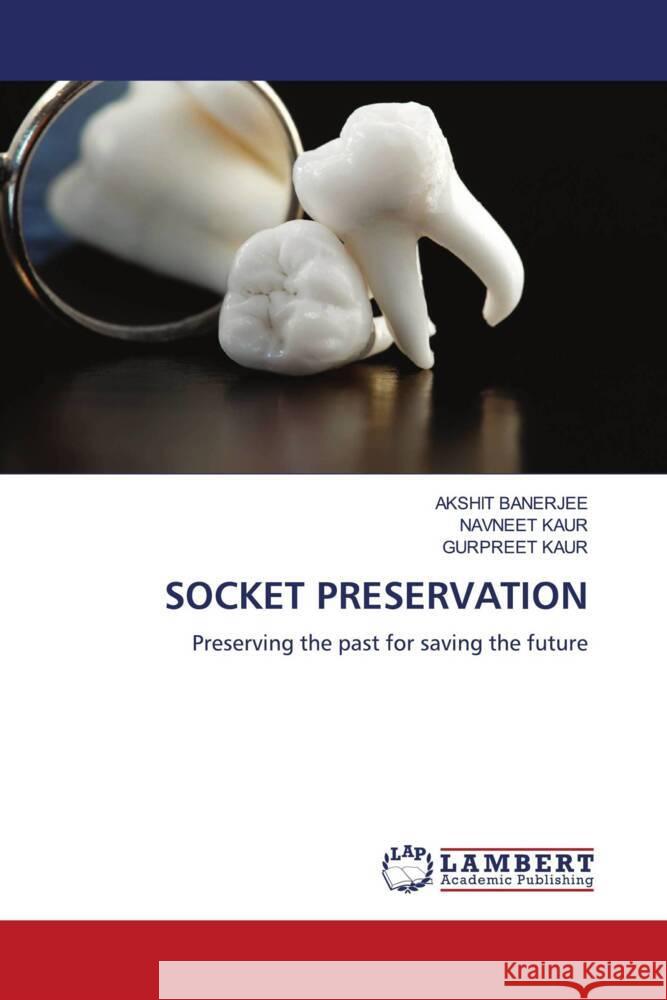 SOCKET PRESERVATION BANERJEE, AKSHIT, Kaur, Navneet, Kaur, Gurpreet 9786205491034 LAP Lambert Academic Publishing