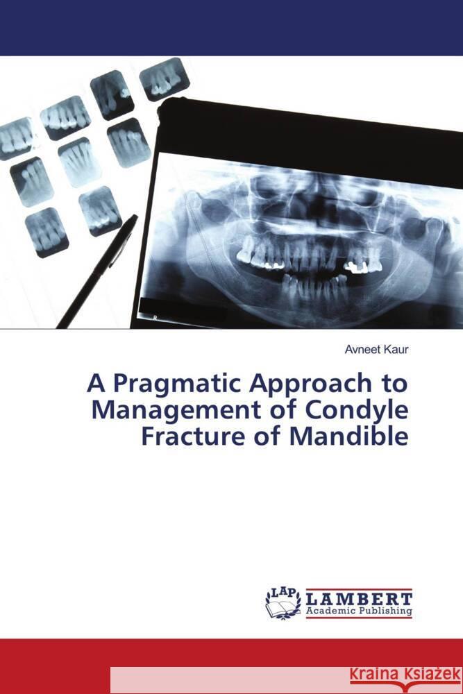 A Pragmatic Approach to Management of Condyle Fracture of Mandible Kaur, Avneet 9786205491171 LAP Lambert Academic Publishing