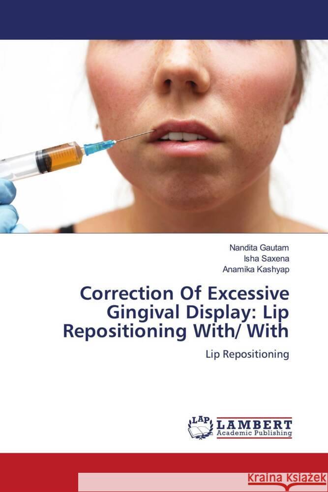 Correction Of Excessive Gingival Display: Lip Repositioning With/ With Gautam, Nandita, Saxena, Isha, Kashyap, Anamika 9786205496343 LAP Lambert Academic Publishing