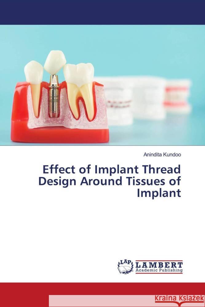 Effect of Implant Thread Design Around Tissues of Implant Kundoo, Anindita 9786205497272