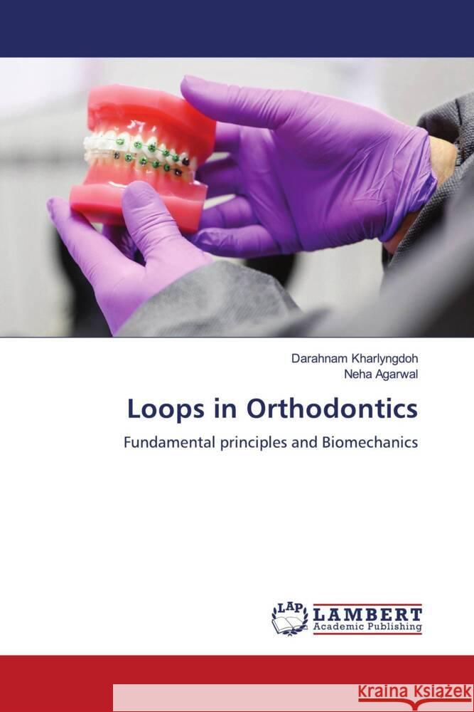 Loops in Orthodontics Kharlyngdoh, Darahnam, Agarwal, Neha 9786205497531