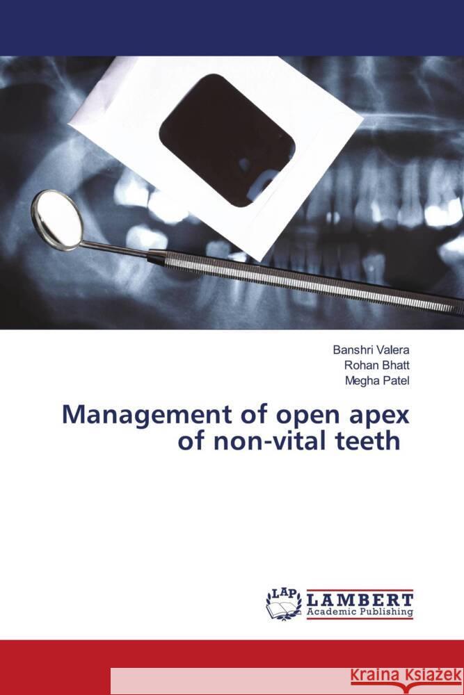 Management of open apex of non-vital teeth Valera, Banshri, Bhatt, Rohan, Patel, Megha 9786205498149 LAP Lambert Academic Publishing