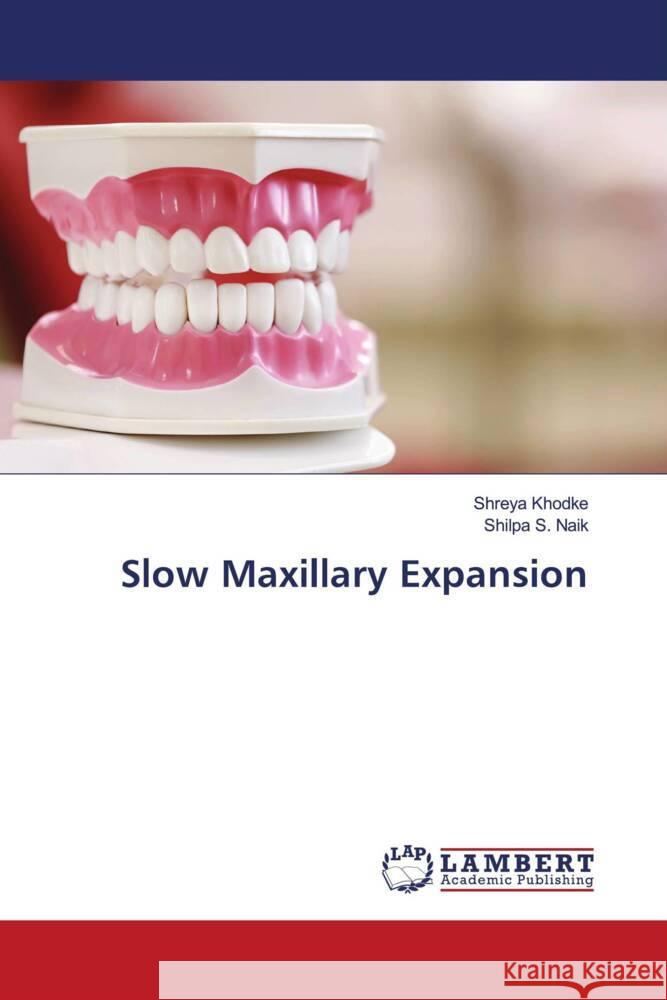 Slow Maxillary Expansion Khodke, Shreya, Naik, Shilpa S. 9786205499962