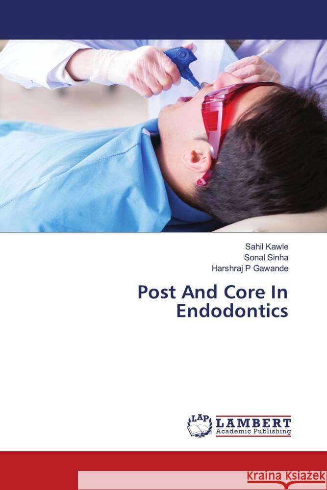 Post And Core In Endodontics Kawle, Sahil, Sinha, Sonal, Gawande, Harshraj P 9786205500491