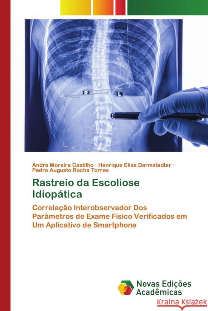 Rastreio da Escoliose Idiopática Castilho, Andre Moreira, Darmstadter, Henrique Elias, Torres, Pedro Augusto Rocha 9786205504130 Novas Edições Acadêmicas