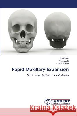 Rapid Maxillary Expansion Alap Shah, Roopa Jatti, K M Keluskar 9786205508473 LAP Lambert Academic Publishing