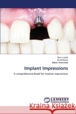 Implant Impressions Renu Ladda, Ruchi Kasat, Babita Yeshwante 9786205510278 LAP Lambert Academic Publishing