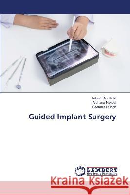 Guided Implant Surgery Aakash Agnihotri Archana Nagpal Geetanjali Singh 9786205514474 LAP Lambert Academic Publishing