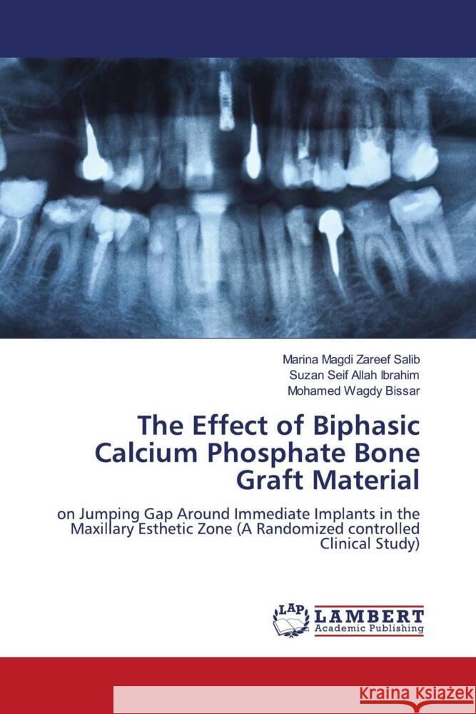 The Effect of Biphasic Calcium Phosphate Bone Graft Material Magdi Zareef Salib, Marina, Seif Allah Ibrahim, Suzan, Wagdy Bissar, Mohamed 9786205514924