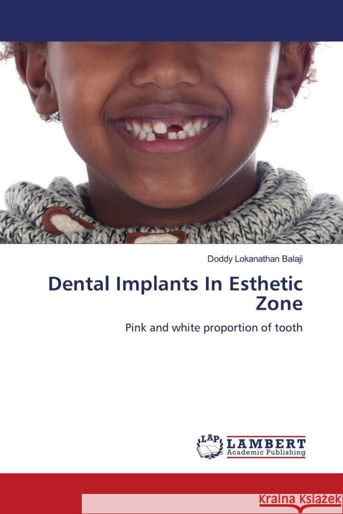 Dental Implants In Esthetic Zone Balaji, Doddy Lokanathan 9786205515204