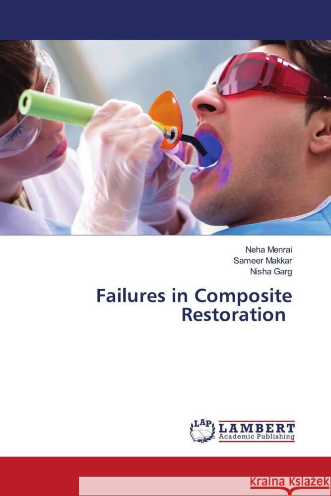 Failures in Composite Restoration Menrai, Neha, Makkar, Sameer, Garg, Nisha 9786205516478