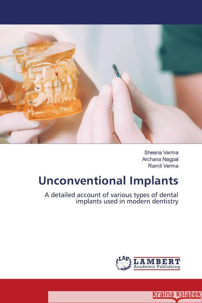 Unconventional Implants Verma, Sheena, Nagpal, Archana, verma, Ramit 9786205519714