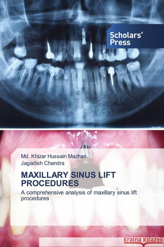 Maxillary Sinus Lift Procedures MD Khizar Hussain Mazhari Jagadish Chandra 9786205521021