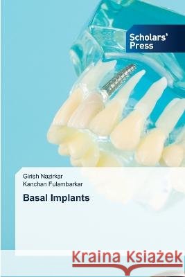Basal Implants Nazirkar, Girish, Fulambarkar, Kanchan 9786205521762