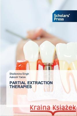 PARTIAL EXTRACTION THERAPIES Singh, Shailendra, Yadav, Aakash 9786205522325 Scholars' Press