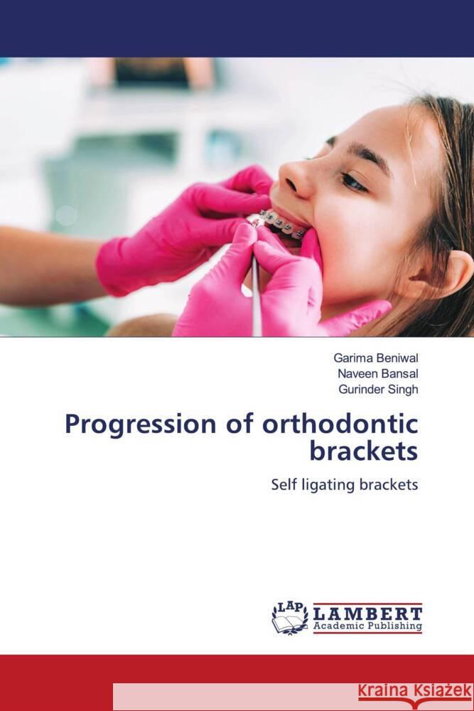 Progression of orthodontic brackets Beniwal, Garima, Bansal, Naveen, Singh, Gurinder 9786205527429