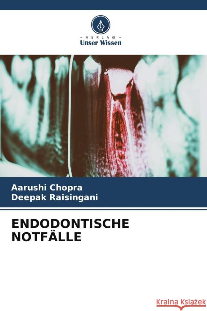 ENDODONTISCHE NOTFÄLLE Chopra, Aarushi, Raisingani, Deepak 9786205540275