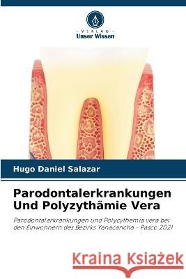 Parodontalerkrankungen Und Polyzyth?mie Vera Hugo Daniel Salazar 9786205556696 Verlag Unser Wissen