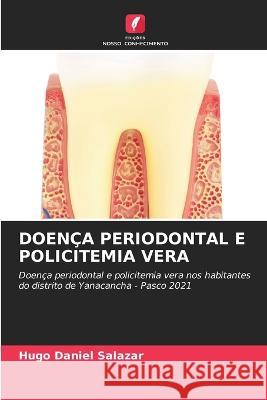 Doen?a Periodontal E Policitemia Vera Hugo Daniel Salazar 9786205556719 Edicoes Nosso Conhecimento