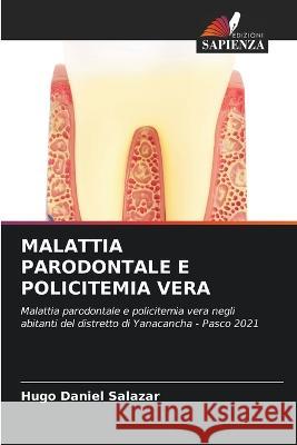 Malattia Parodontale E Policitemia Vera Hugo Daniel Salazar 9786205556764 Edizioni Sapienza